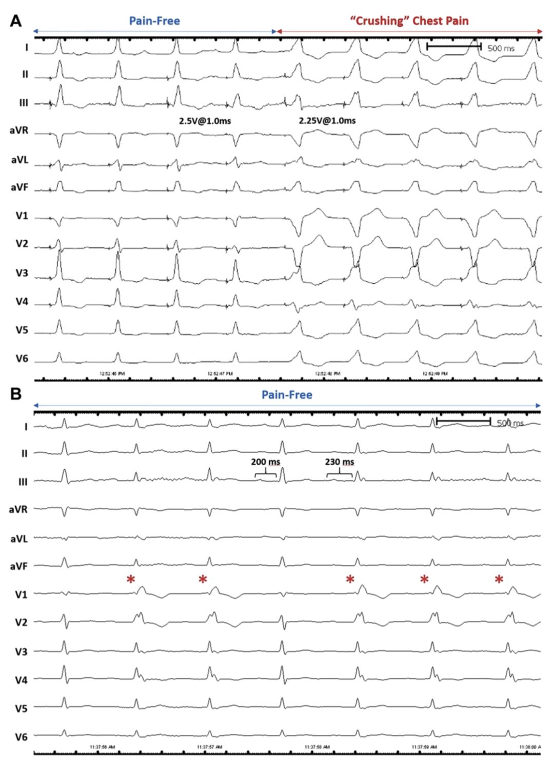 疼痛性神经痛怎么治疗,疼痛神经阻滞教程