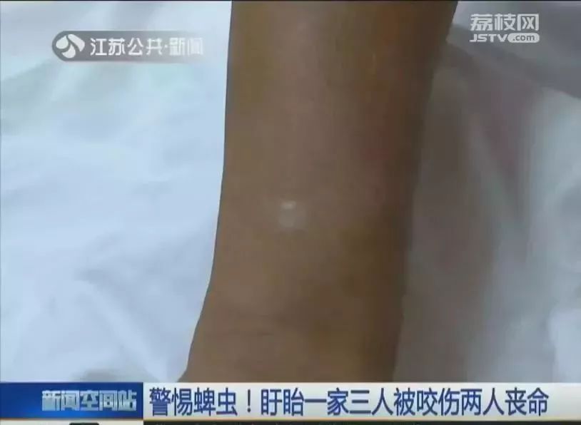 男童眼皮突然有了痣,小孩眼皮上突然出针尖大的红点