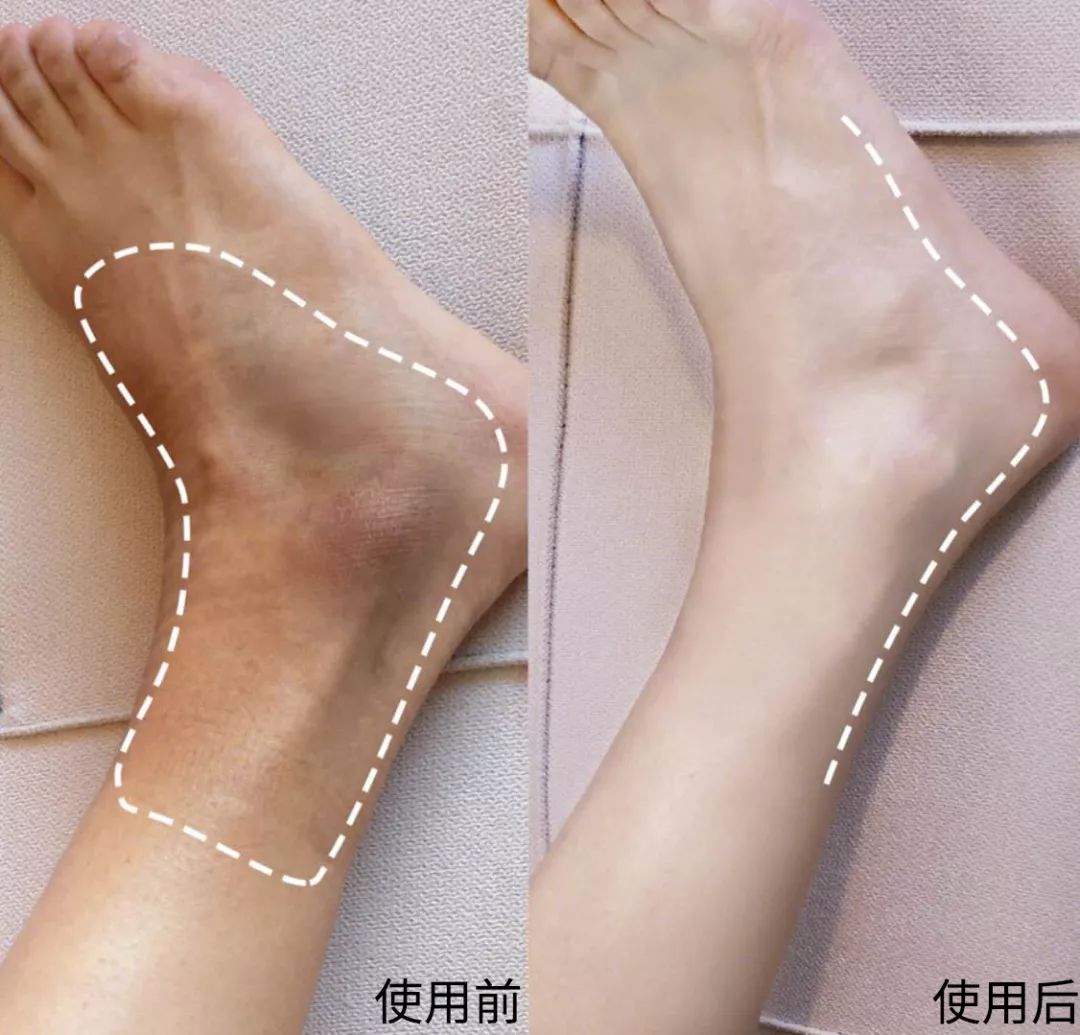 裸感美腿|1瓶=20双*袜丝**！3秒喷出“裸感”大美腿！隐形毛孔、鸡皮肤！短裙绝配