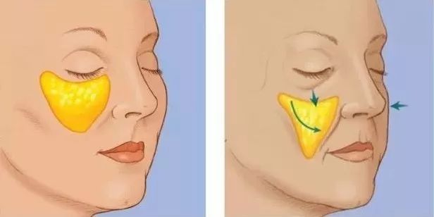 十五年恍如隔世,15年少女时代回归