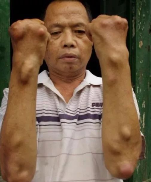 拿什么拯救我的你,拿什么拯救我的植物