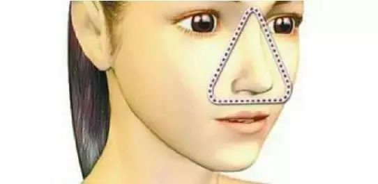 怎么把脸上的黑头清掉,去黑头推荐全脸