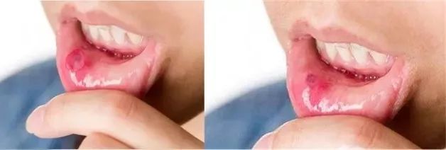 3秒清新口气口腔持久留香,3秒永久去除口臭