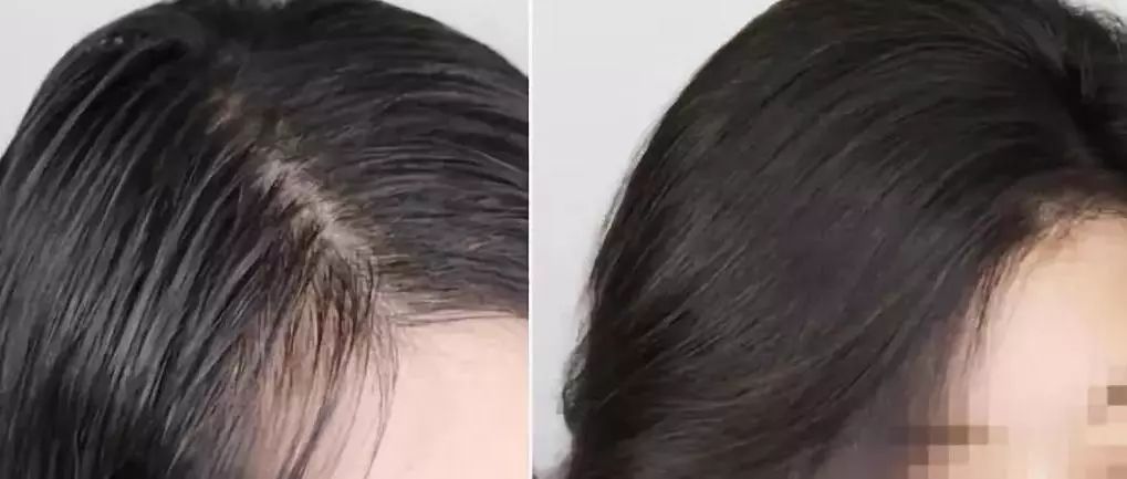 超短发细软塌怎么打理,拯救发量理发