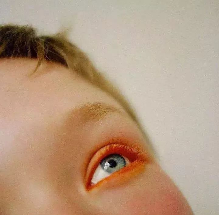 不医美怎么保养,不吃药如何快速美白全身