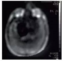 农场里走出CT鼻祖，美苏核危机诞生磁共振！