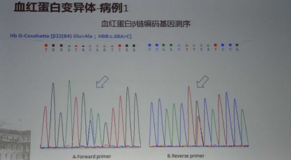 周翔海教授:糖化血红蛋白测量值不准确可能与这些因素有关|PUDF2019
