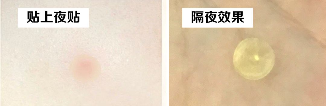 灰头土脸怎么改善,灰头土脸怎么预防