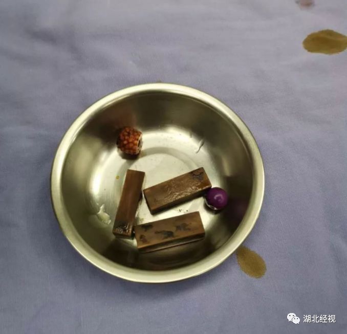 妈妈发现女儿身上有怪味,妈妈发现女儿过敏体质后续