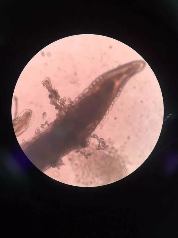 4岁女宝宝最近叫小便处痒,四岁女宝宝说小便地方痒和痛