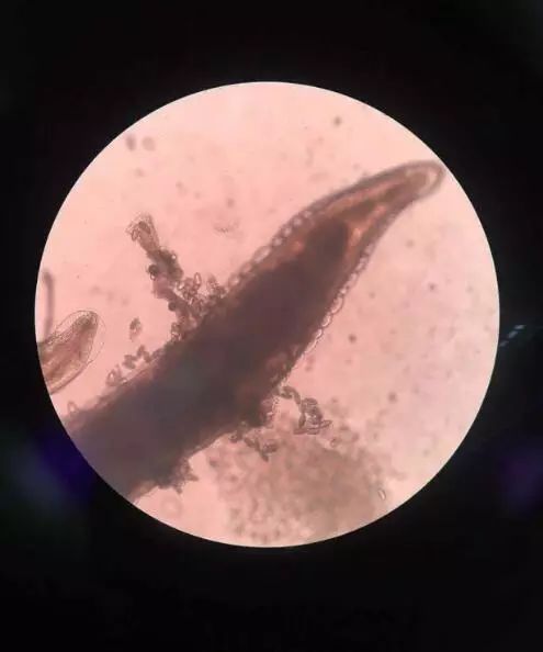 4岁女童屁屁痒，妈妈检查后吓坏了！一粒粒竟还会动...这个季节高发