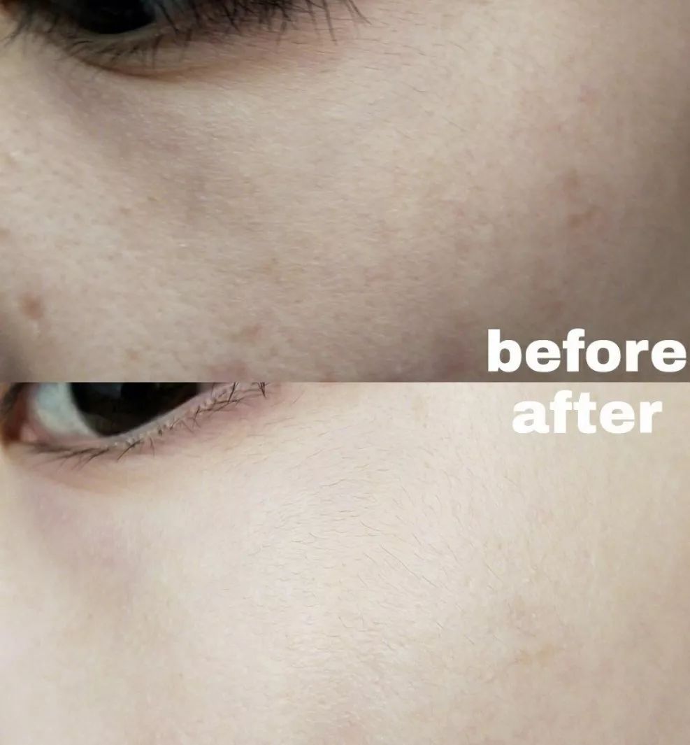 有必要用哪一款水乳,一辈子就能用一套水乳