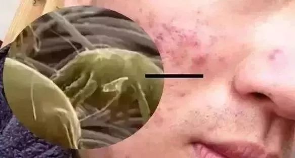 蚕丝被相关报道,桑蚕丝被曝光