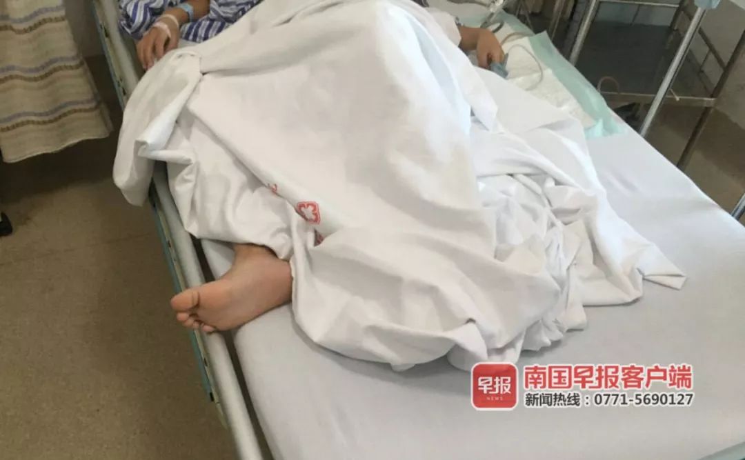 吓人!11岁男孩在家中玩耍,竟将一根4.5厘米长缝衣针塞入*体下**