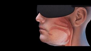 智能止鼾神器防止打呼噜超声波,智能止鼾器治疗打鼾