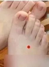 头疼前额疼是什么原因引起的,头疼前额疼左右头顶疼