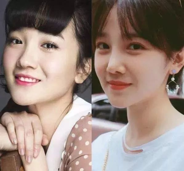 脚底注射肉毒毒素多少钱,脚底注射肉毒素的危害