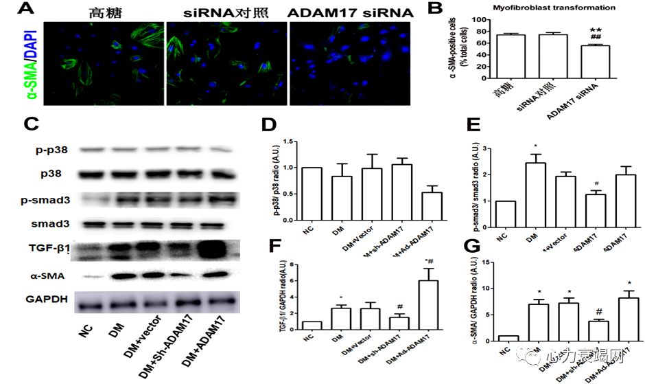 「2019CIHFC」张运教授:ADAM17—糖尿病性心肌病干预的新靶点