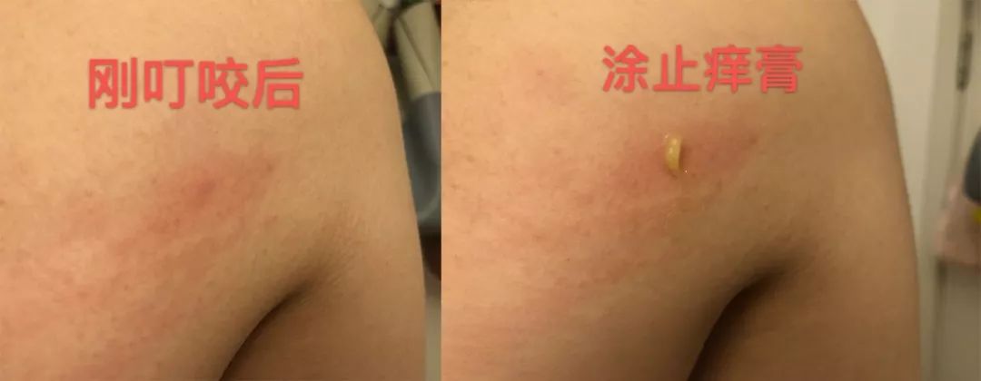 最好的修复膏,亲测好用的修护万能膏