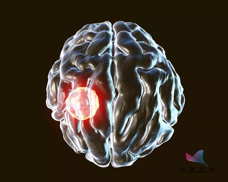 怀孕可以同时养猫狗吗,怀孕了家中养的猫狗会有影响吗