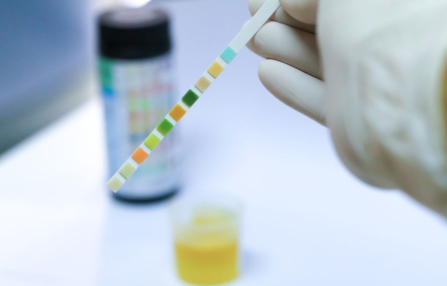 【科普】上厕所时尿液很黄、尿骚味重、有泡沫？这几种情况是大病来袭！你别知道得太晚