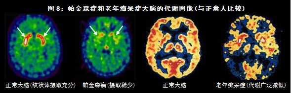 检查癌症最先进的仪器,目前最先进的查癌症的设备是