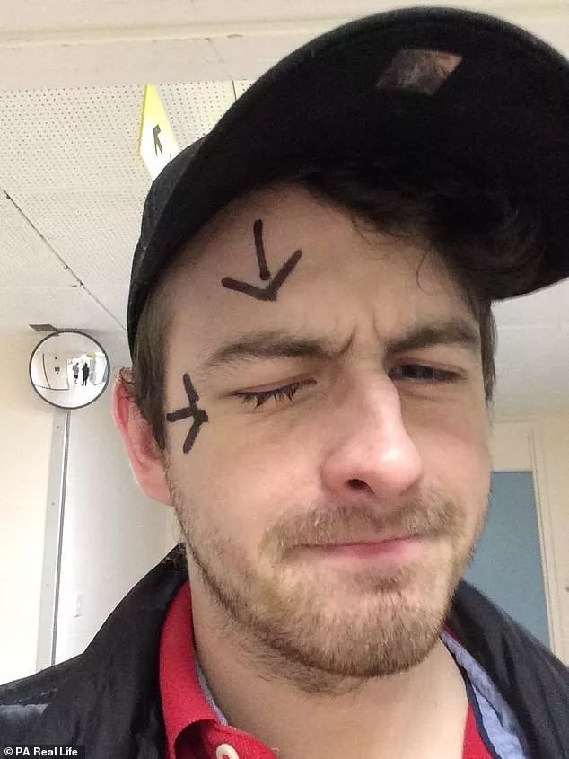 戴隐形眼镜眼睛进虫子怎么办,戴隐形眼镜长寄生虫前有哪些症状