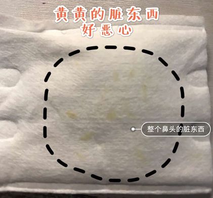 草莓鼻去黑头好物推荐使用,草莓鼻去黑头导出液