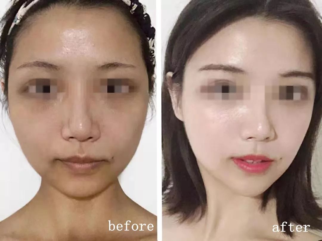 黑科技一秒祛斑,黑科技美白真的有效吗