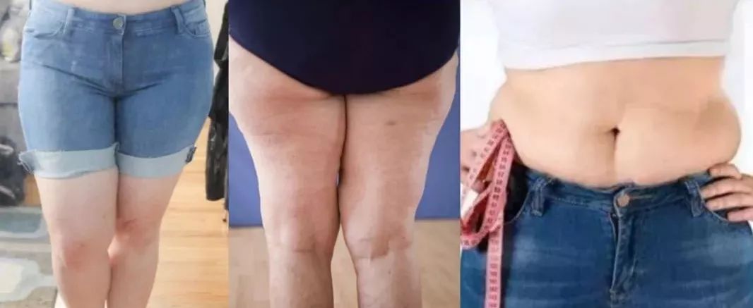 半个娱乐圈撞*裤内**？谁叫它提臀细腰又瘦腿