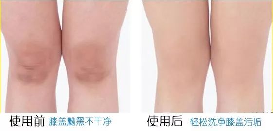 搓背长条沐浴刷,懒人浴室搓背刷