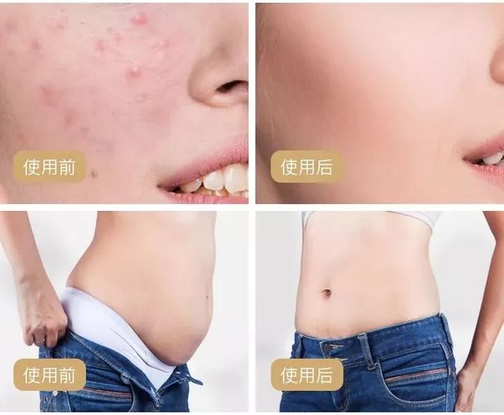 睡前祛湿泡脚配方有哪些,睡前坚持用它泡脚3件好事找到你