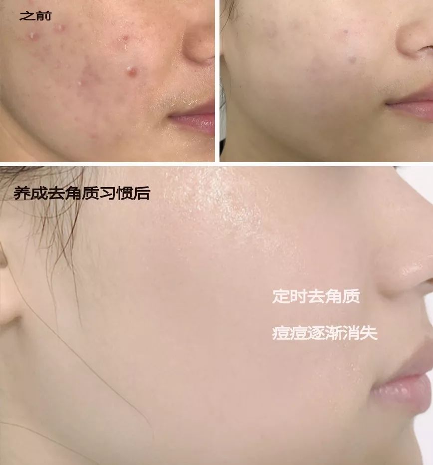 脸上搓出3斤泥！难怪又黄又暗又黑头！10秒给脸蛋“剥壳”，厉害