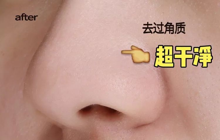 柔嫩抛光|脸上搓出3斤泥!难怪又黄又暗又黑头!10秒给脸蛋“剥壳”,厉害