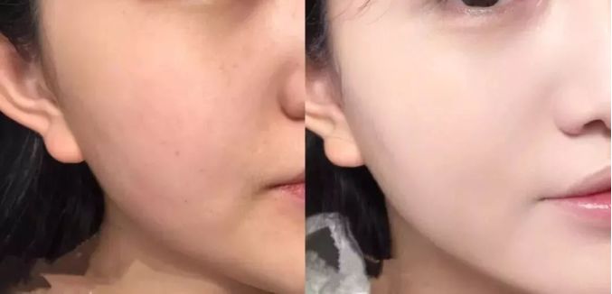 脸上搓出3斤泥！难怪又黄又暗又黑头！10秒给脸蛋“剥壳”，厉害