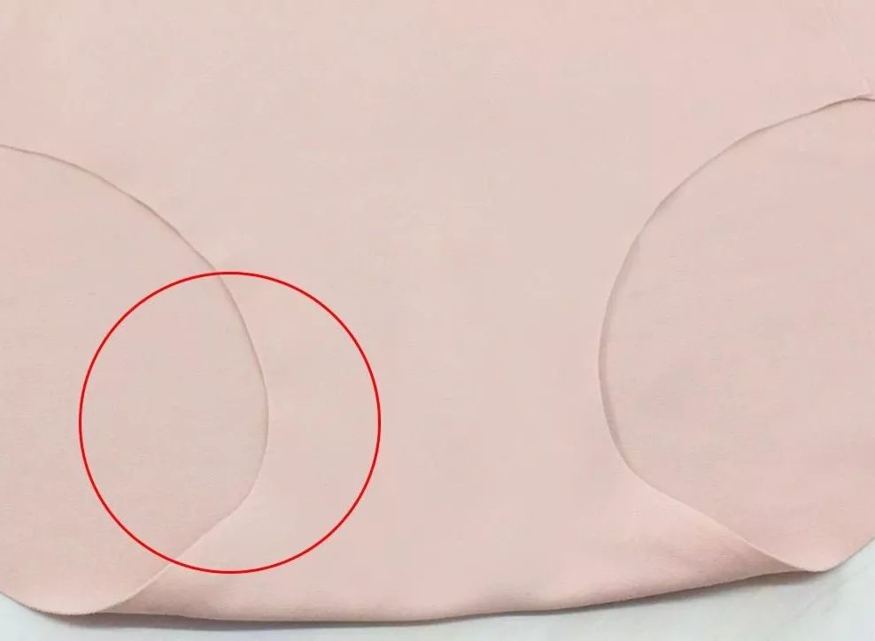 夏天内衣勒痕后特别痒怎么办,夏天内衣勒痒怎么办