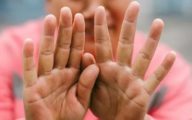 手上长了脚气,手上长了脚气用什么药