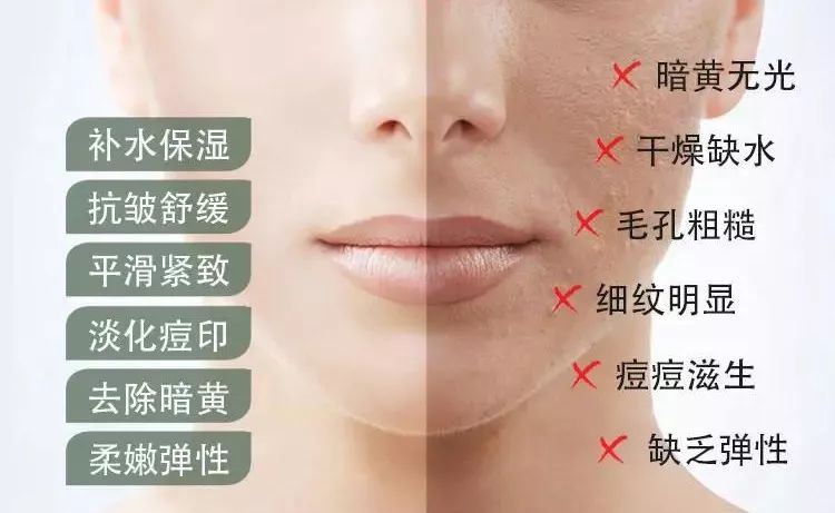 芦荟胶祛痘补水晒后修复,零添加无危害芦荟胶补水推荐