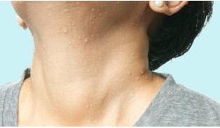 人无汗心不安！出汗部位可以看出你的身体健康状况，准