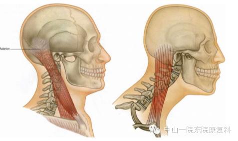 康复治疗技术人体解剖学,12条筋膜链解析及治疗手法