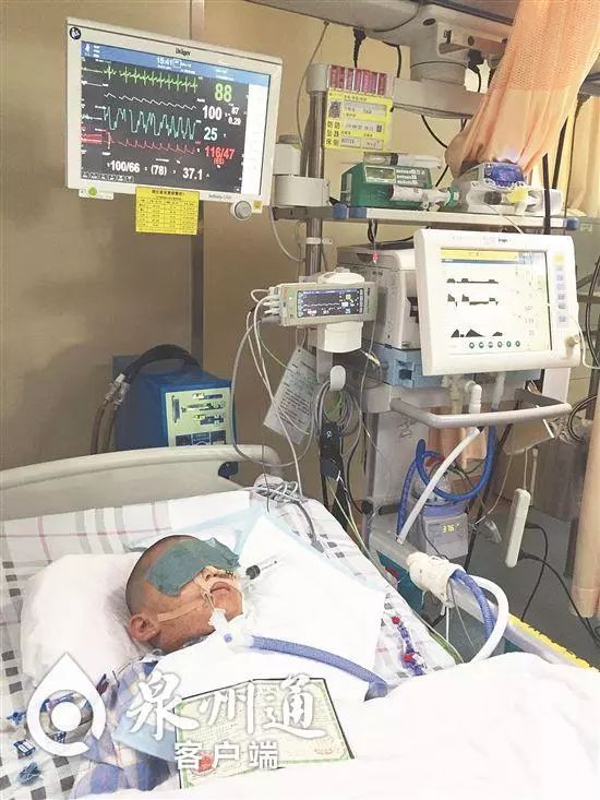 当心有毒虫,夏季当心这6种小虫被咬可能丧命