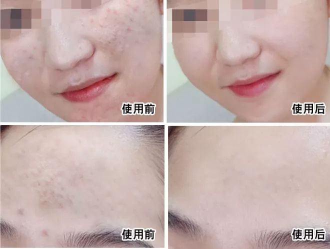 新西兰草本植物精华,新西兰精华液护肤品