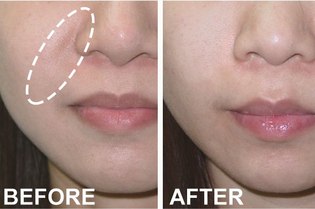 法令纹又黑又长,法令纹又深又长好吗