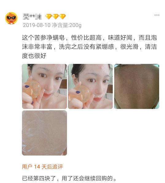 可美金箔祛痘螨虫皂,除螨皂能祛螨虫吗