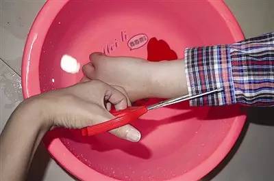 心疼！菏泽一月嫂抱仅40天男婴做饭时锅中鸡蛋突然爆开，孩子腿和肚皮烫出了泡...