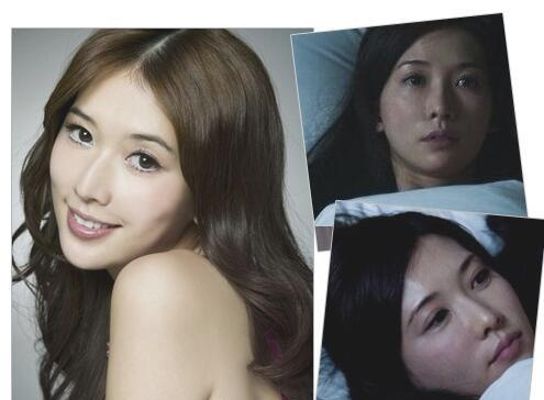 皮肤有点红有红血丝怎么办,面部皮肤有红血丝怎么能治好