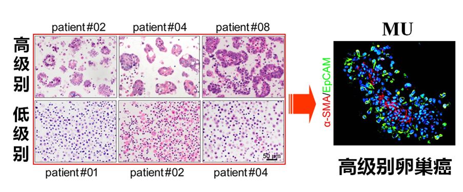高庆蕾医学专家,高庆蕾卵巢癌生活方案