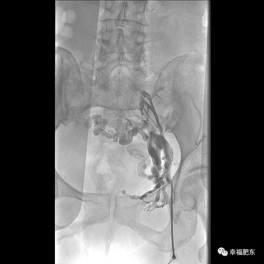 福音！咱肥东县医院这个领域又有新科技突破~