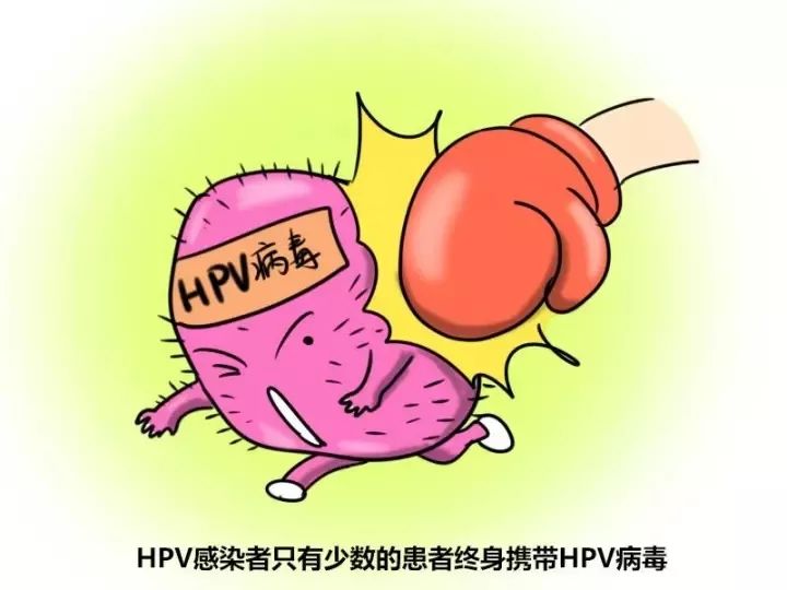 hpv感染了要注意的事项,hpv感染临床治疗观念