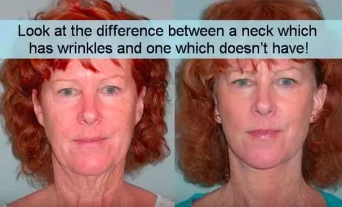 蛋白贴去皱,胶原蛋白颈纹贴